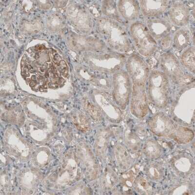 Immunohistochemistry-Paraffin: THSD7A Antibody [NBP1-93612]