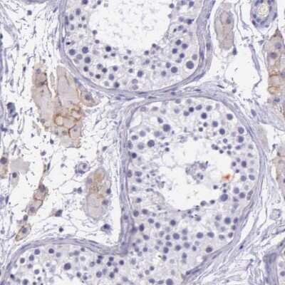 Immunohistochemistry-Paraffin: THSD7A Antibody [NBP1-93612]