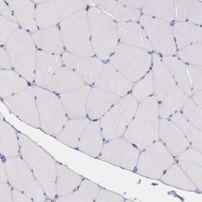 Immunohistochemistry-Paraffin: THSD7A Antibody [NBP1-93612]