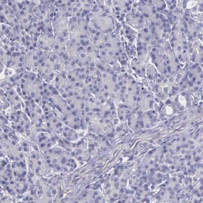 Immunohistochemistry-Paraffin: THSD7A Antibody [NBP1-93612]