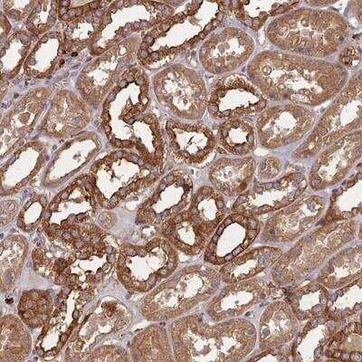 Immunohistochemistry-Paraffin: THSD7B Antibody [NBP2-14736]