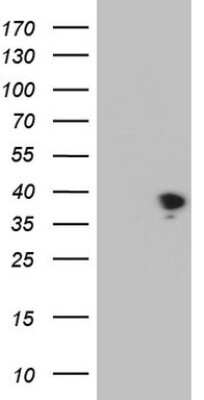 Western Blot: THTPA Antibody (OTI13E3) [NBP2-46122]