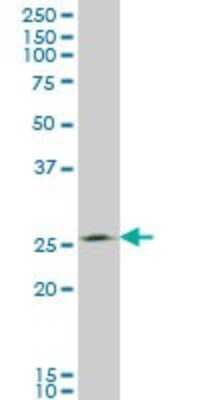 Western Blot: THTPA Antibody (3F6) [H00079178-M01]