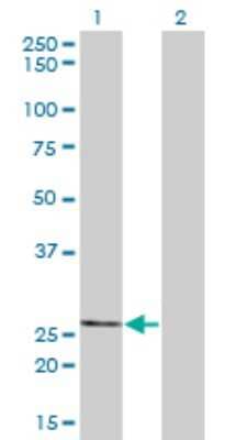 Western Blot: THTPA Antibody (3F6) [H00079178-M01]