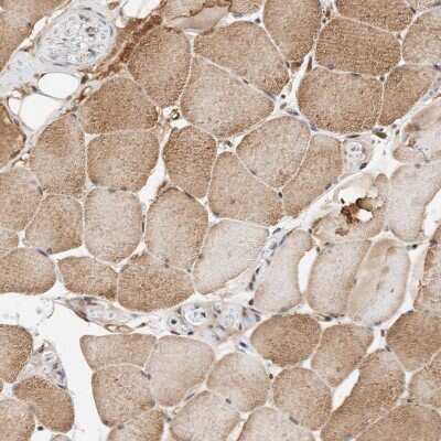 Immunohistochemistry-Paraffin: THTPA Antibody [NBP1-80686]
