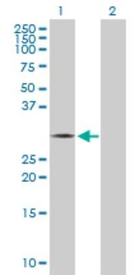 Western Blot: THTPA Antibody [H00079178-D01P]