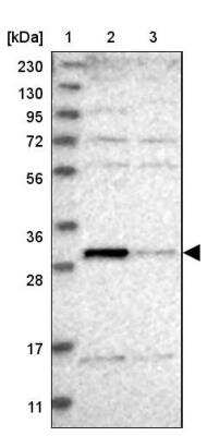 Western Blot: THTPA Antibody [NBP1-80686]