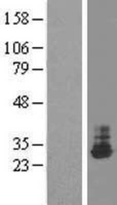 Western Blot: THTPA Overexpression Lysate [NBP2-09424]