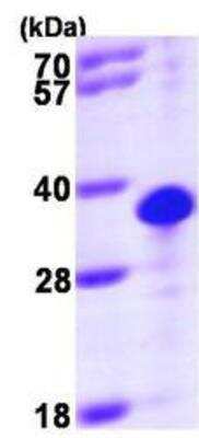 Western Blot: Recombinant Human THTPA His Protein [NBP1-45325]