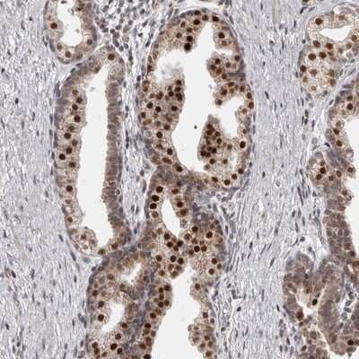 Immunohistochemistry-Paraffin: THUMPD1 Antibody [NBP1-82194]