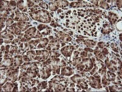 Immunohistochemistry: THUMPD1 Antibody (OTI1H6) - Azide and BSA Free [NBP2-74512]