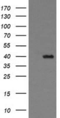 Western Blot: THUMPD1 Antibody (OTI1H6)Azide and BSA Free [NBP2-74512]