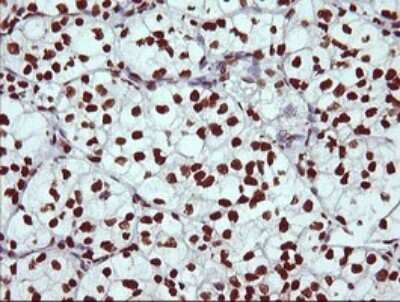 Immunohistochemistry: THUMPD1 Antibody (OTI1H6) [NBP2-45996]