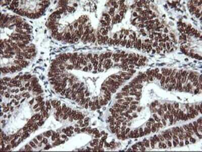 Immunohistochemistry: THUMPD1 Antibody (OTI1H6) [NBP2-45996]