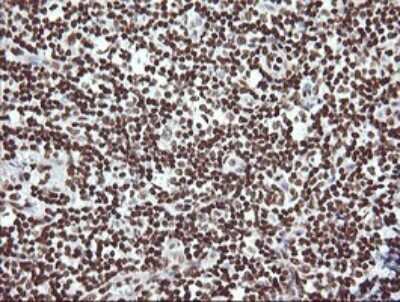 Immunohistochemistry: THUMPD1 Antibody (OTI1H6) [NBP2-45996]