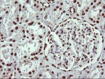 Immunohistochemistry: THUMPD1 Antibody (OTI1H6) [NBP2-45996]