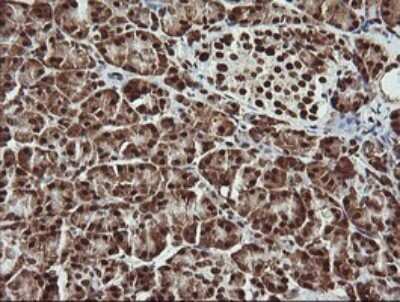 Immunohistochemistry: THUMPD1 Antibody (OTI1H6) [NBP2-45996]