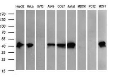 Western Blot: THUMPD1 Antibody (OTI1H6) [NBP2-45996]