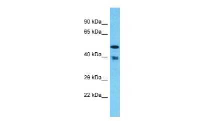 Western Blot: THUMPD1 Antibody [NBP2-88434]