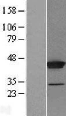 Western Blot: THUMPD1 Overexpression Lysate [NBL1-16901]