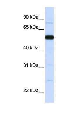 Western Blot: THUMPD2 Antibody [NBP1-55086]