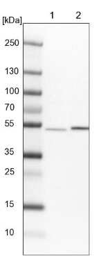 Western Blot: THUMPD2 Antibody [NBP1-92504]