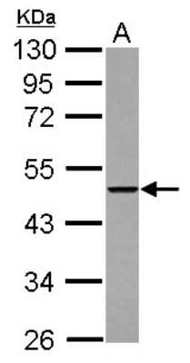 Western Blot: THUMPD2 Antibody [NBP2-20625]