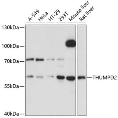 Western Blot: THUMPD2 AntibodyAzide and BSA Free [NBP2-93708]