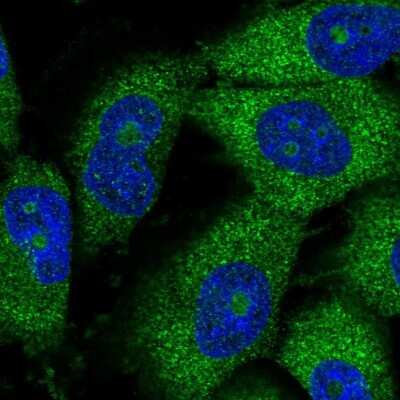 Immunocytochemistry/ Immunofluorescence: THUMPD3 Antibody [NBP2-38287]