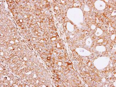 Immunohistochemistry-Paraffin: THUMPD3 Antibody [NBP1-32500]