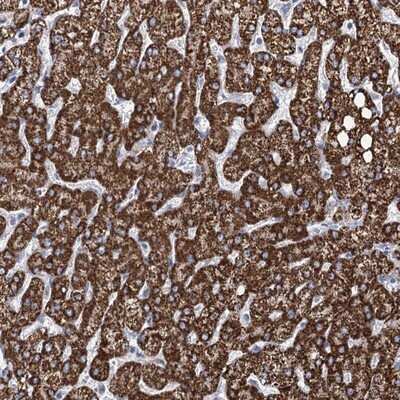 Immunohistochemistry-Paraffin: THUMPD3 Antibody [NBP1-85132]