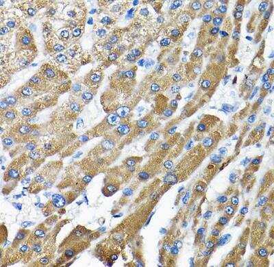 Immunohistochemistry-Paraffin: THUMPD3 Antibody - BSA Free [NBP2-93482]