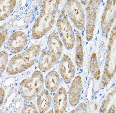 Immunohistochemistry-Paraffin: THUMPD3 Antibody - BSA Free [NBP2-93482]