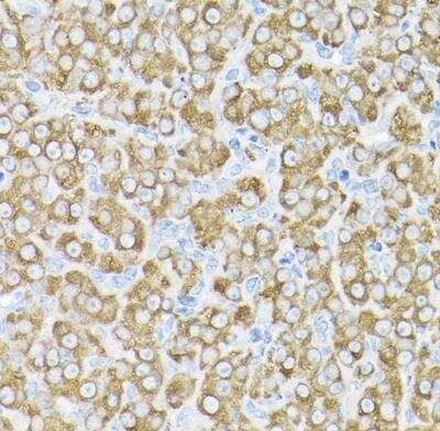 Immunohistochemistry-Paraffin: THUMPD3 Antibody - BSA Free [NBP2-93482]