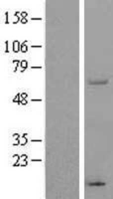 Western Blot: THUMPD3 Overexpression Lysate [NBL1-16903]