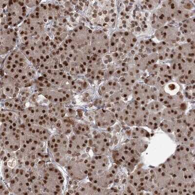 Immunohistochemistry: THYN1 Antibody [NBP2-32645]