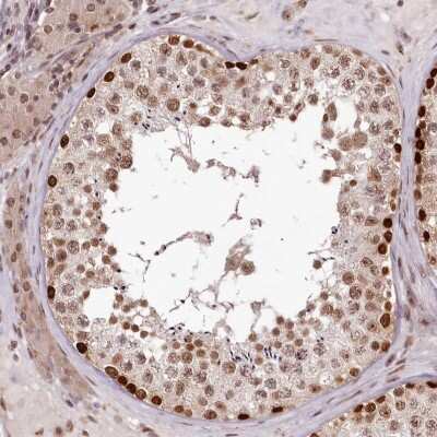 Immunohistochemistry-Paraffin: THYN1 Antibody [NBP1-86942]