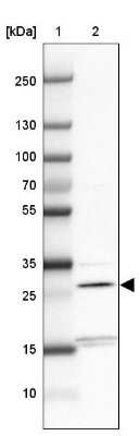 Western Blot: THYN1 Antibody [NBP2-32645]