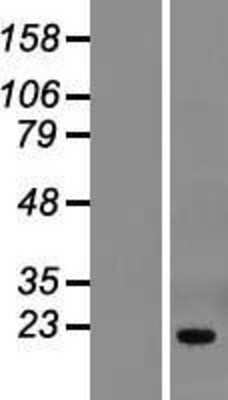 Western Blot: THYN1 Overexpression Lysate [NBL1-16905]