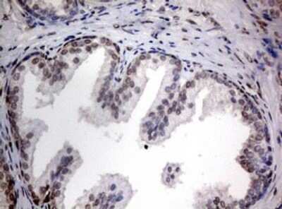 Immunohistochemistry: TIA1 Antibody (OTI1D7) [NBP2-46132]