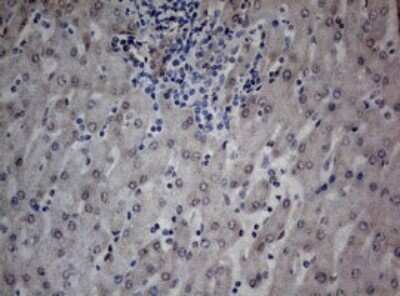 Immunohistochemistry: TIA1 Antibody (OTI1D7) [NBP2-46132]