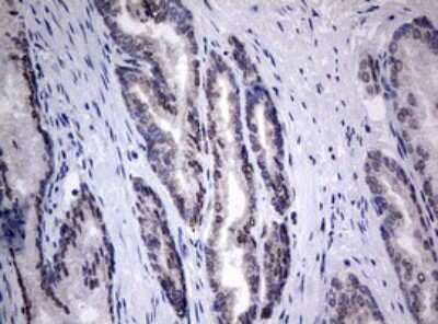 Immunohistochemistry: TIA1 Antibody (OTI1D7) [NBP2-46132]