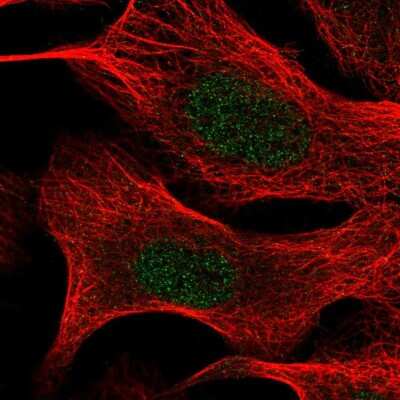 Immunocytochemistry/ Immunofluorescence: TIA1 Antibody [NBP2-54962]