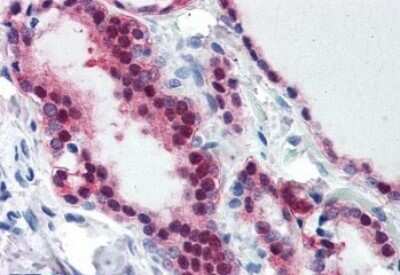Immunohistochemistry-Paraffin: TIA1 Antibody [NB100-60555]
