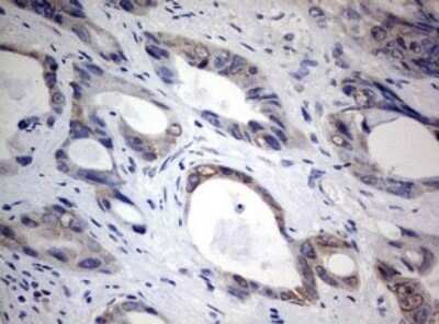 Immunohistochemistry: TIA1 Antibody (OTI1D7) - Azide and BSA Free [NBP2-74513]
