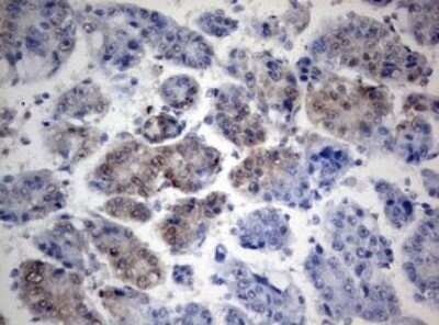 Immunohistochemistry: TIA1 Antibody (OTI1D7) - Azide and BSA Free [NBP2-74513]
