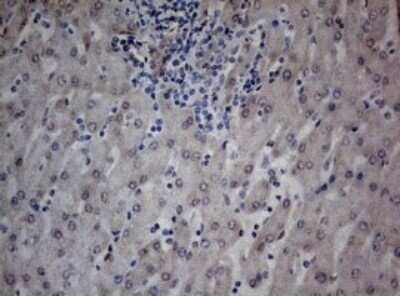 Immunohistochemistry: TIA1 Antibody (OTI1D7) - Azide and BSA Free [NBP2-74513]