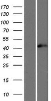 Western Blot: TIA1 Overexpression Lysate [NBP2-06452]