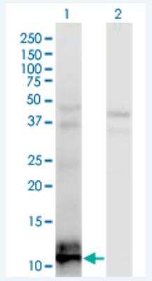 Western Blot: TIAF1 Antibody (3B9) [H00009220-M04-100ug]