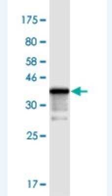 Western Blot: TIAF1 Antibody (3B9) [H00009220-M04-100ug]